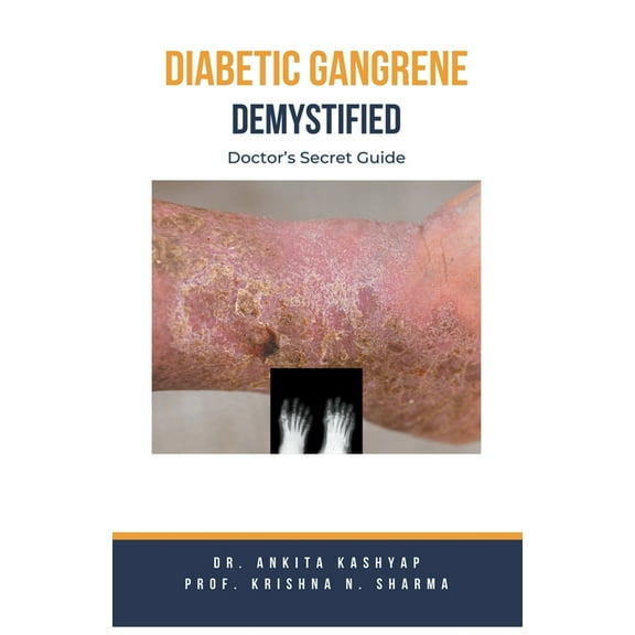 Diabetic Gangrene Demystified: Doctor's Secret Guide, (Paperback)