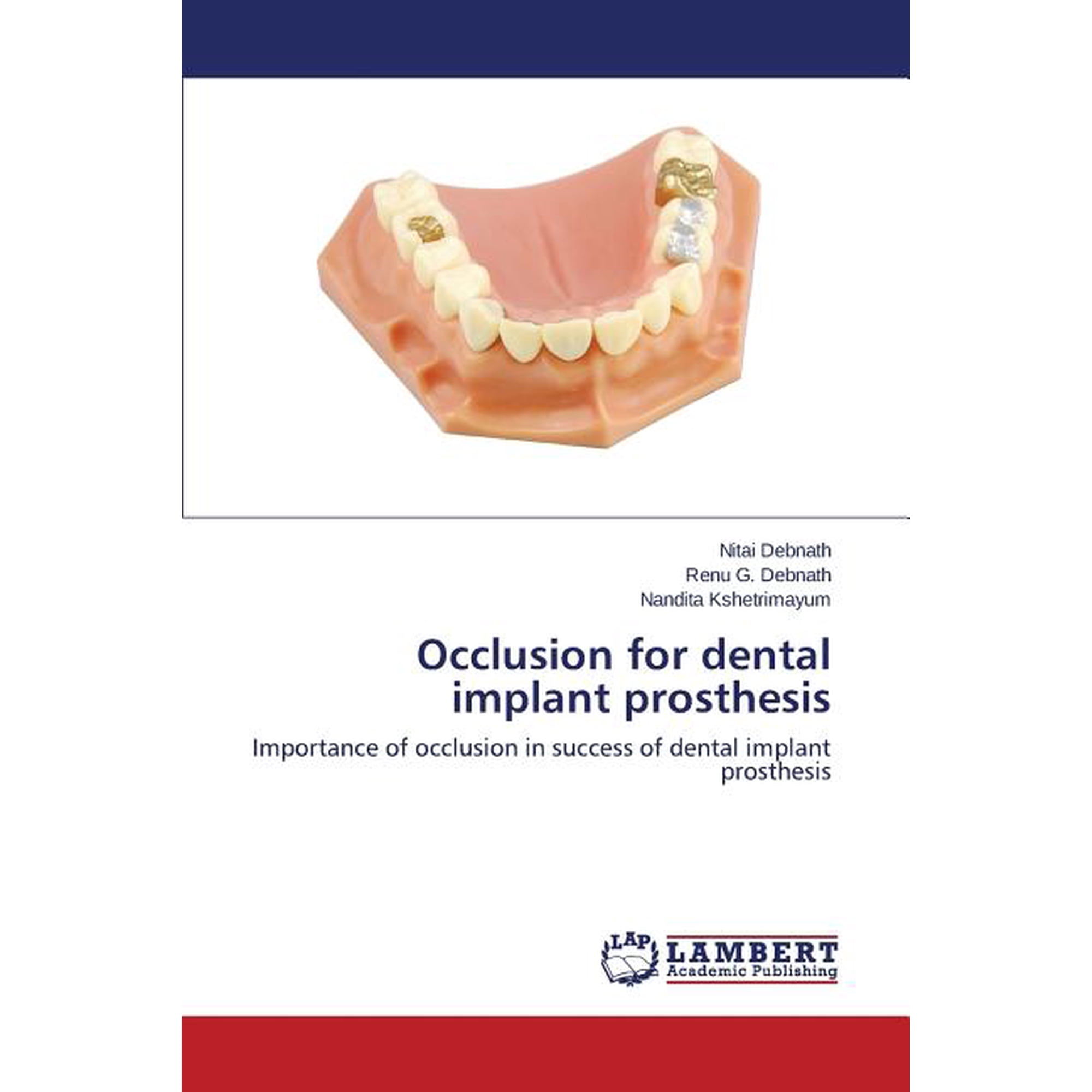 Occlusion for Dental Implant Prosthesis (Paperback)