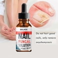 thumbnail image 2 of 1-3pcs Nail Fungal Solution, Nail Repair for Fingernails Toenails, 2 of 5