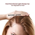 thumbnail image 1 of Infrared Hair Growth Instrument(B), 1 of 5