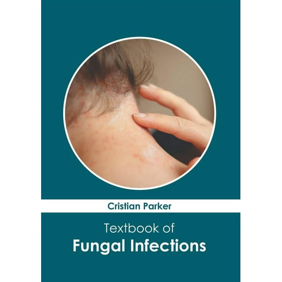 Textbook of Fungal Infections, (Hardcover)