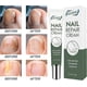 thumbnail image 3 of 2026 Nail Care Nail Repair Cream Nail Fungus Treatment Onychomycosis Nail Carenail Repair Cream Nail Moisturizing Restore Beautiful Nails Fungi Nail F, 3 of 5
