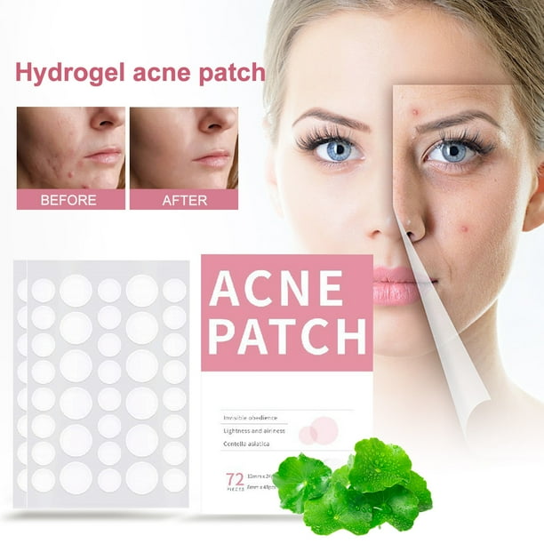 Parche para el acné Parches transparentes para espinillas con microagujas, 2 tamaños para maquillaje invisible, parche hidratante impermeable para el acné para cerrar el acné y atenuar las marcas del