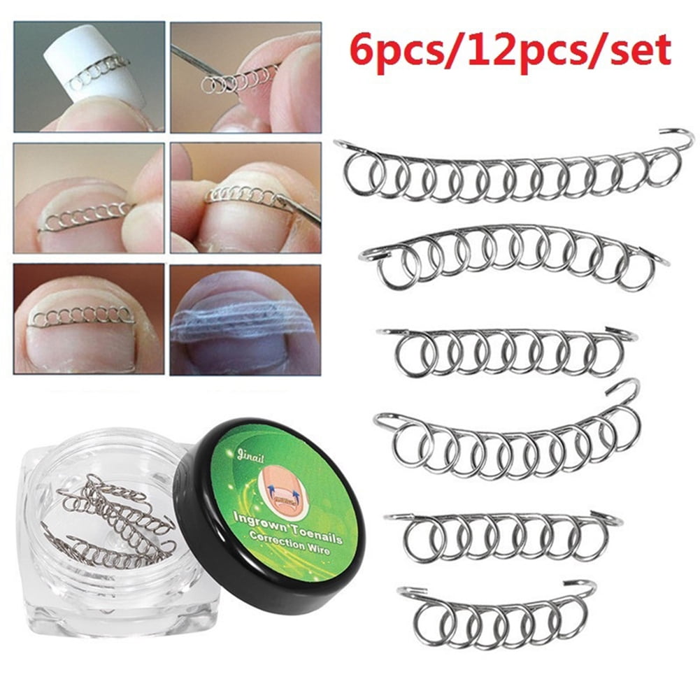 Taluosi 6/12Pcs Ingrown Toenail Correction Wire Fixer Foot Care