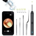 thumbnail image 1 of Herramienta de eliminación de cera de oídos, limpiador de oídos WiFi inalámbrico con cámara FHD de 1296P, removedor de cera de oídos, otoscopio de alcance de oído con luz, 1 of 5