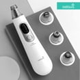 thumbnail image 3 of Limpiador eléctrico de puntos negros Youpin Wellskins Limpiador profundo de poros Acné Espinillas, 3 of 8