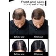 thumbnail image 4 of Sevich-Bolsa de recarga de fibras capilares, extensión de cabello Calvo, polvo de crecimiento, salón, tratamiento profesional del cabello, productos para la pérdida de cabello Unisex, 100g, 4 of 5