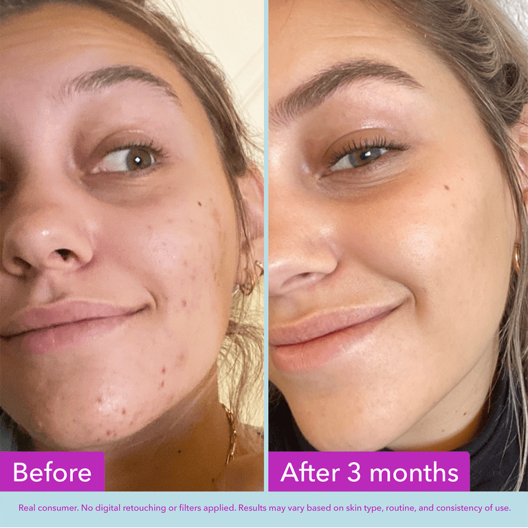 Niacinamide Brightening Face Toner photo 3