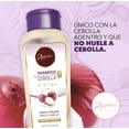 thumbnail image 3 of Anyeluz Trio de Cebolla,Shampoo de Cebolla,Terapia Capilar Crecimiento y Tonico, 3 of 12