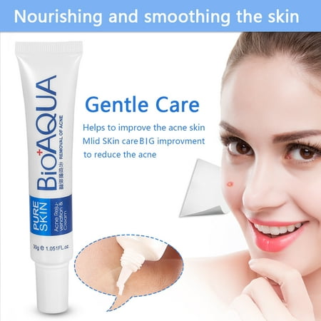 VGEBY Anti-Acne Pimple Treatment Cream Shrink Pores Oil-Control Facial Skin Moisturizing, Spots Removal Cream, Pimple Treatment