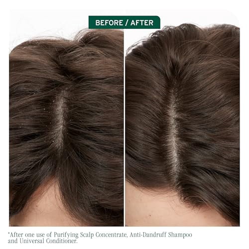 Biolage Scalp Sync Anti-Dandruff Shampoo - Controls Dandruff and Deeply Cleanses With Zinc Pyrithione Vegan and Cruelty-Free Packaging may vary