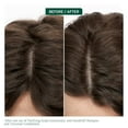 thumbnail image 4 of Biolage Scalp Sync Anti-Dandruff Shampoo - Controls Dandruff and Deeply Cleanses With Zinc Pyrithione Vegan and Cruelty-Free Packaging may vary, 4 of 4