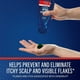thumbnail image 3 of Shampoo Medicado Selsun Blue 11 Onzas, 3 of 4