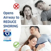 SleepRight Snore Aid – Mouthguard, FDA-Approved for Snoring, Includes Top & Bottom Trays & Case, 1 Count