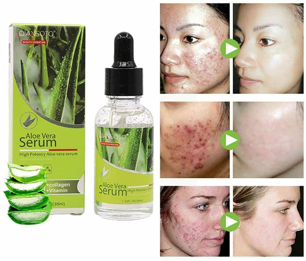 Antagonisme Onafhankelijkheid compromis Aloe Vera Pure Aloe Essence Natural Facial Serum Soothing Liquid Skin  Repair - Walmart.com