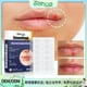 thumbnail image 5 of Hot6sl Ofertas Del Día Parches Smootheal para Herpes Labial Parche Curativo Discreto para Herpes Labial: Un Parche Que Protege y Oculta El Herpes Labial, 5 of 7