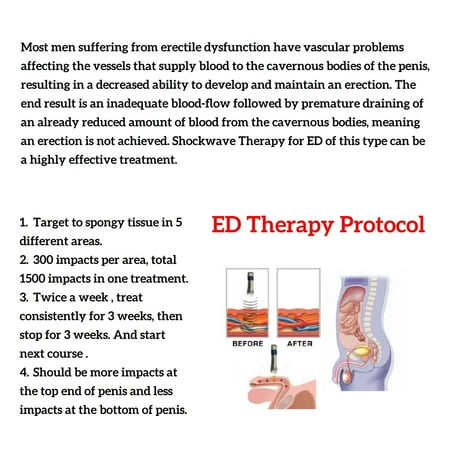 ヒンディー語版ウィキペディアの勃起不全
