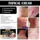 thumbnail image 5 of Crema antipicazón South Moon para ampollas, manos y pies, piel seca con picazón, crema antipicazón para picaduras de mosquitos, crema reparadora, loción y humectante (1 unidad), 5 of 5