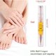 thumbnail image 2 of 5ML nail nutrition pen removal of fungal nail repair fluid, 2 of 5