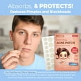 thumbnail image 2 of MEDca Universal Acne Patches | 2 Sizes | Hydrocolloid Bandages | 360 Pcs, 2 of 9