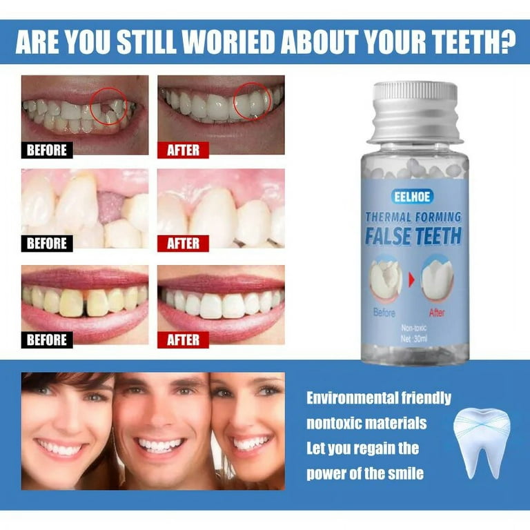 2023 Tooth Filling Kit Temporary Dental Repair Cement Teeth Gap Falseteeth  Solid Glue Fake Teeth Glue Tooth Gaps dental products