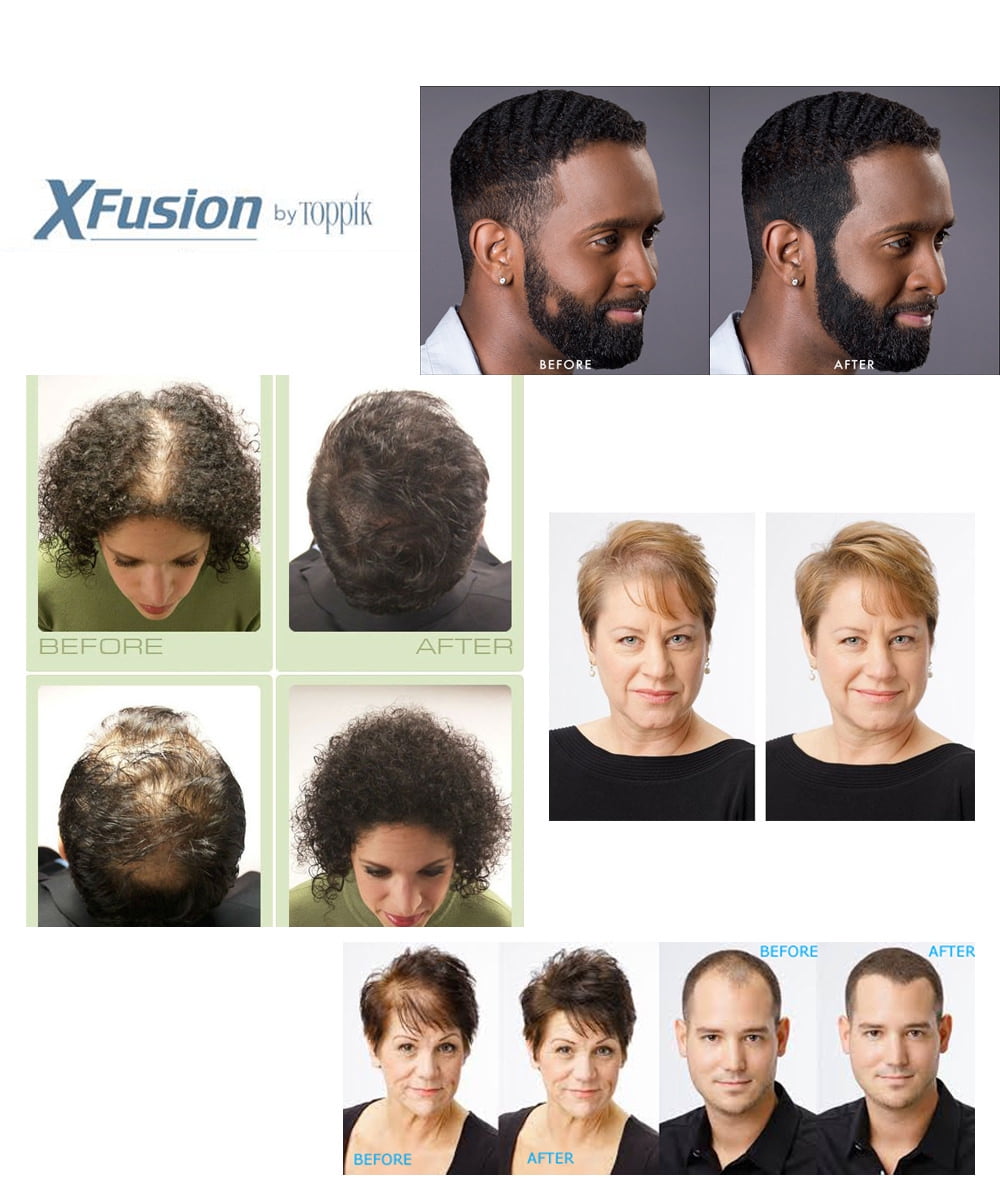 XFusion Genuine Keratin Hair Fibers Economy Size Black 28g XFusion Genuine Keratin Hair Fibers Economy Size Black 28g