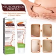 thumbnail image 3 of Pregnancy Stretch Cream, Enhance Elasticity Hydrating Stretch Marks Remover  For Body Skincare, 3 of 8