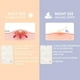 thumbnail image 4 of 8pack Pimple Patches Acne Healing Patch - Spot Patches Hydrocolloid Absorbing Cover, Invisible, Blemish Spot, Skin Treatment, Facial Stickers, Two Sty, 4 of 5