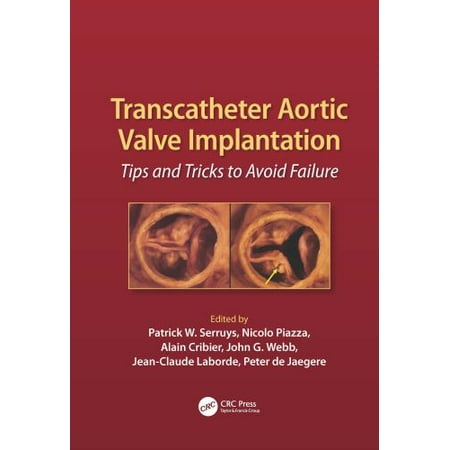 Transcatheter Aortic Valve Implantation : Tips and Tricks to Avoid Failure, Used [Hardcover]