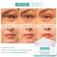 thumbnail image 4 of Crema de Retinol ANGGREK 2.5% de Retinol activo 30ml, 4 of 8