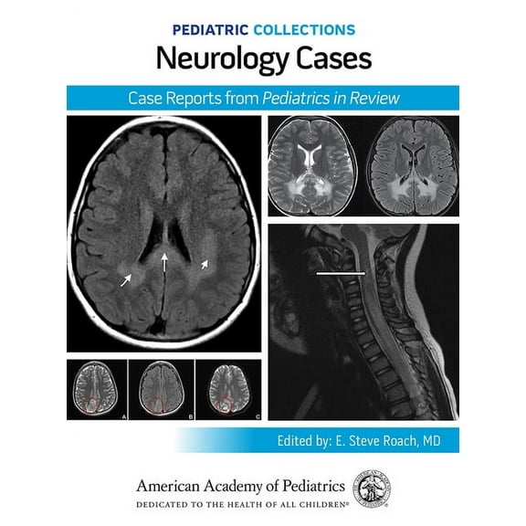 Pediatric Collections Pediatric Collections: Neurology Cases: Case Reports from Pediatrics in Review, (Paperback)