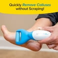 Calluses Lighting PedEgg Cordless Motorized Callus Remover with Bright LED Light for Feet ...