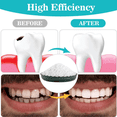thumbnail image 2 of perlas de reparación de dientes, de reparación de empastes dentales dientes postizos moldeables 25g,perlas de ajuste térmico instantáneo de relleno temporal, de reparación de, 2 of 10