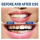 thumbnail image 4 of SP-14 Probiotic Whitening Toothpaste Ultra Whitening Boost Up Stain Removal, Deep Cleaning Fresh Breath Toothpaste with Probiotics, 4 of 5