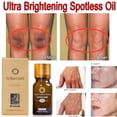 thumbnail image 1 of 2 Pcs Brightening Spotless Oil Dark Spots Removal Age Hyper Pigmentation 10ml, 1 of 5