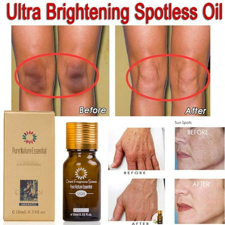 2 Pcs Brightening Spotless Oil Dark Spots Removal Age Spots Hyper