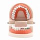 thumbnail image 4 of 1pc Dental Orthodontic Typodont With Ortho Metal Ceramic Bracket Arch Wire Orthodontic Toothed Denture, 4 of 4