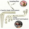 thumbnail image 5 of Dental Implant Guide Set,6pcs/Set Implant Guide Set Dental Implant Guide Locator,Dental Implant Locating Guide Plate for Dentist Orthodontic Tools, 5 of 5