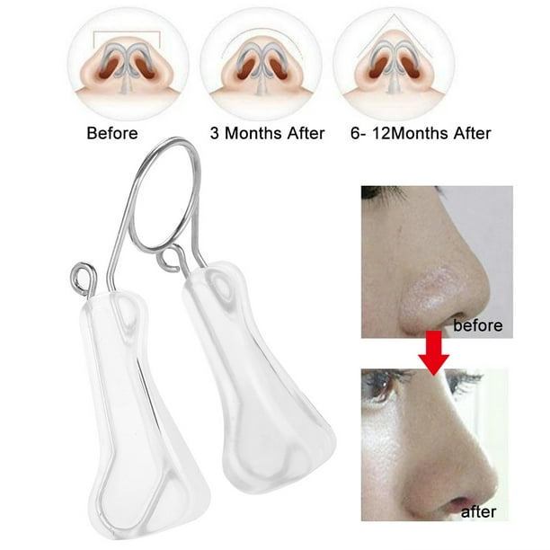Nose Shaper Nose Up Shaping Nose Lifting Tool Nose Nose Up Shaping Bridge  Reshaper Lifting Straightening Clip Beauty Tool White 
