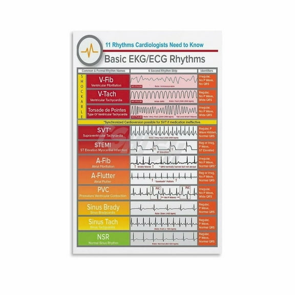 EKG Knowledge Poster Basic ECG1 Heart Rhythms Hospital Wall Art (4) Canvas Painting for Living Room Bedroom Decor