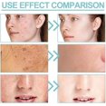 thumbnail image 3 of Jabón 20x, jabón blanquer extremo para rostro y cuerpo con Bubble Net, limpieza profunda, exfoliación, hidratación y suavidad., 3 of 4