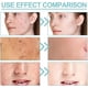 thumbnail image 3 of Jabón 20x, jabón blanquer extremo para rostro y cuerpo con Bubble Net, limpieza profunda, exfoliación, hidratación y suavidad., 3 of 4