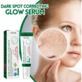 thumbnail image 2 of Suero eliminador de manchas oscuras, crema blanqueadora antienvejecimiento, pigmentación, brillo, Chloasma, 2 of 5