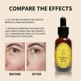 Frankincense Resin Oil, Frankincense Oil for Face, Frankincense Resin Infused Organic Black Seed