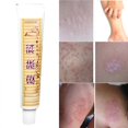 thumbnail image 4 of Psoriasis Cream Relieve Skin itching for Dermatitis and Eczema Pruritus Psoriasis Ointment Creams New, 4 of 5