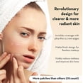 thumbnail image 2 of Parche hidrocoloide para acné LE GUSHE K-BEAUTY Parches para espinillas, 2 of 7