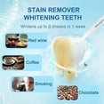 thumbnail image 3 of Teeth Whitening Kit with LED Light Teeth Whitening Gel Pen Mouth Tray  Hydrogen Carbamide Peroxide for Sensitive Teeth  LED Light Tooth Whitener  Teeth Stain Remover to Whiten Teeth, 3 of 8