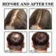 thumbnail image 4 of Esencia natural para el crecimiento del cabello, aceite antipérdida de cabello de 29ml para tratamiento de belleza del cuero cabelludo Tmvgtek Cuidado Belleza, 4 of 6