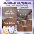 thumbnail image 3 of Mascarilla exfoliante para pies LANBENA con lavanda y vitamina C, 2 pares, 3 of 9