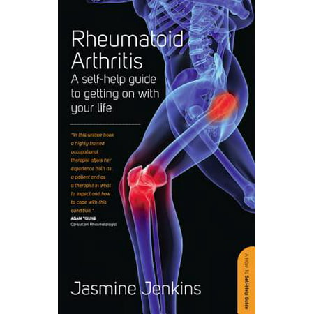 Rheumatoid Arthritis - eBook
